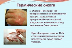 Термические ожоги