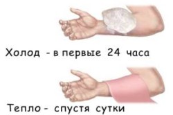 Помощь при ушибе руки