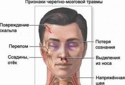 Признаки черепно-мозговой травмы