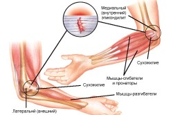 Строение локтевого сустава