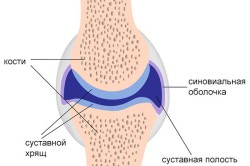 Синовит