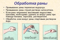 Правила обработки ран
