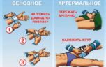 Как оказать первую помощь при бытовой травме?