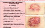 Грануляция и другие фазы заживления раны
